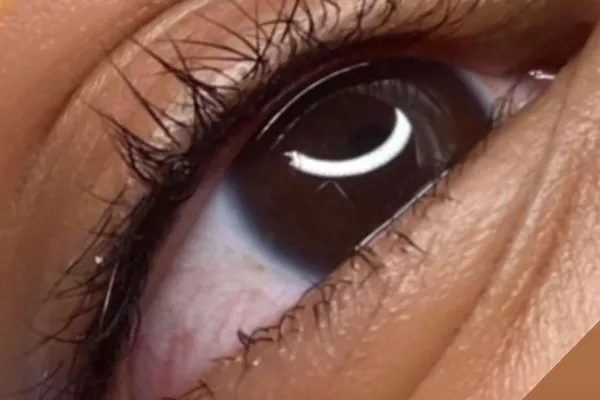 Retouche  lashliner comprise