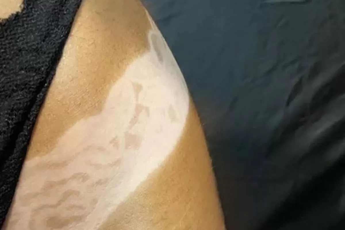 Bronzage par brumisation (corps complet)
