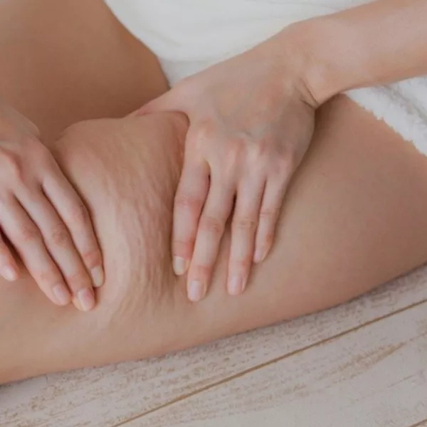 La cellulite et la menopause : Comprendre et Agir