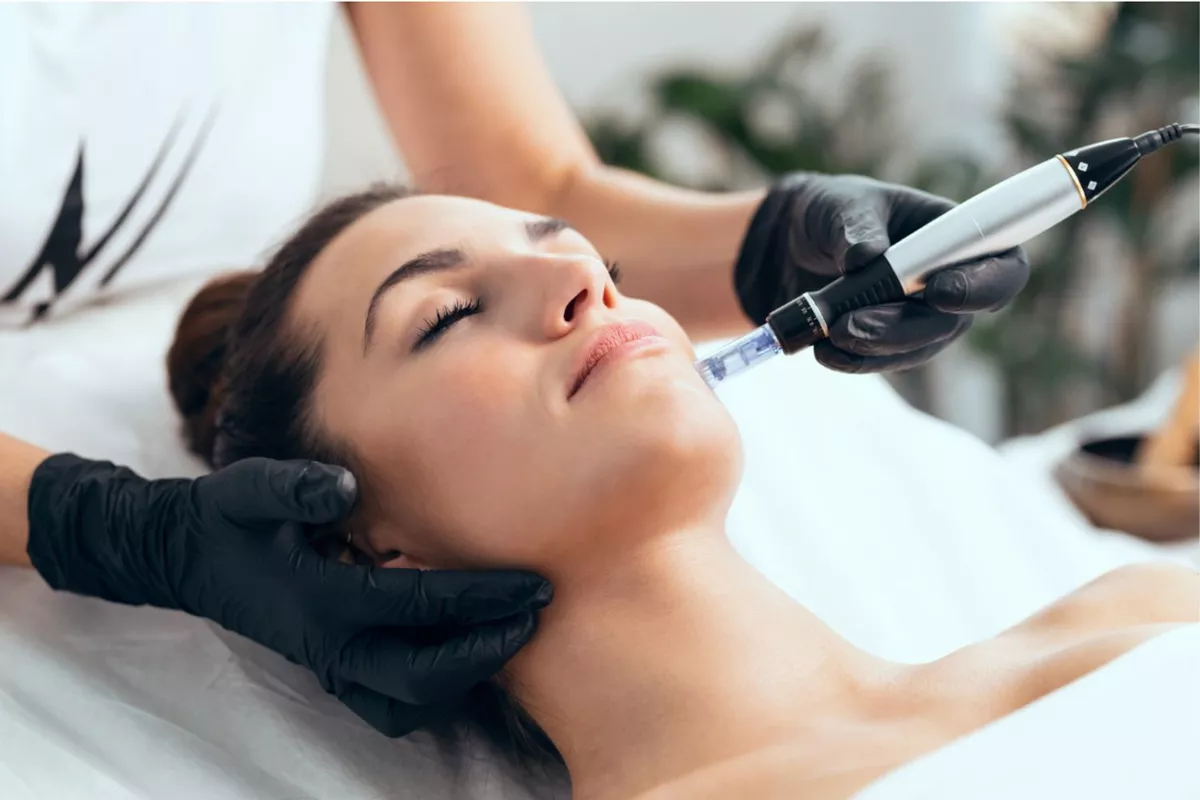 Needling Cure 4 seances