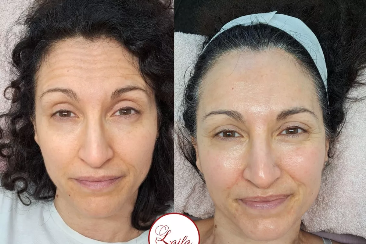 Peeling bio Bois-Guillaume