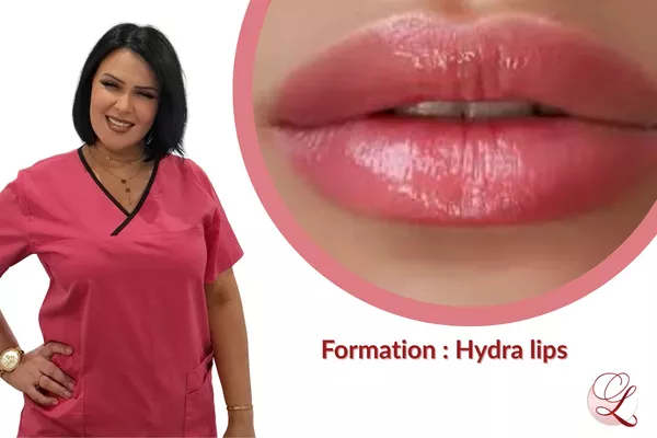 Formation Hydra lips