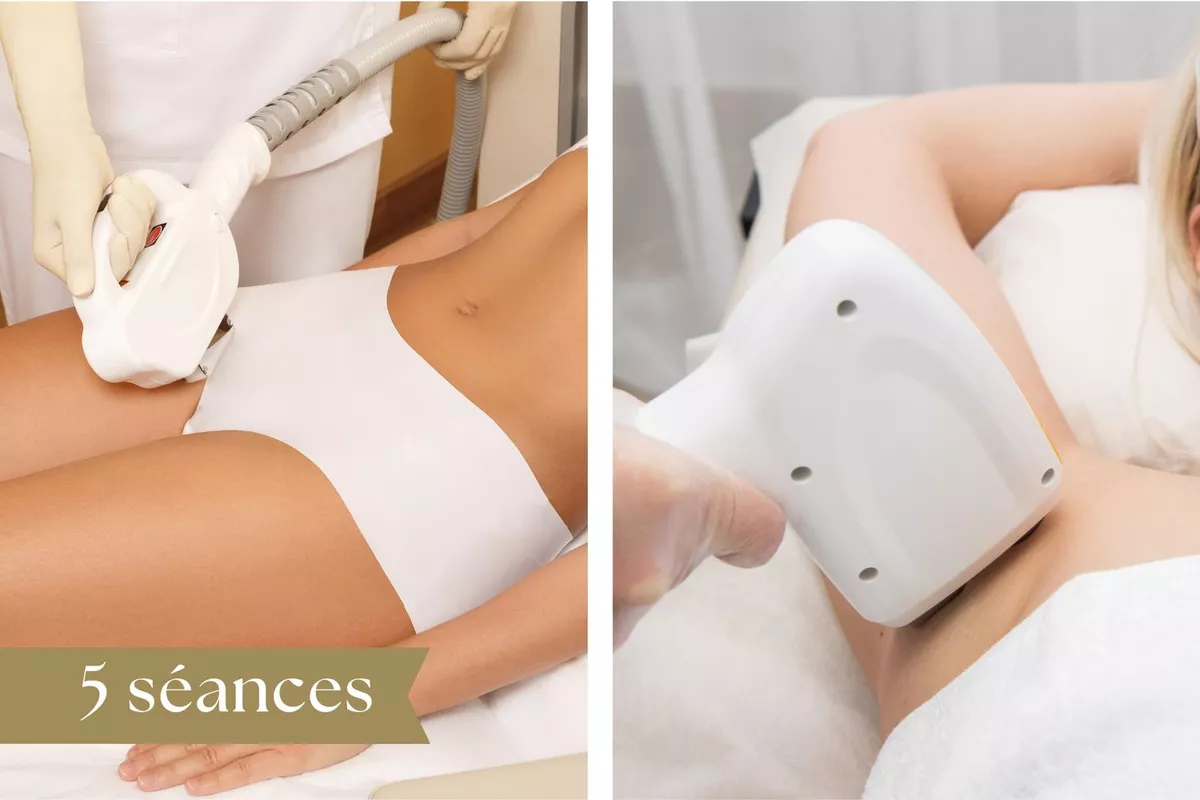 Forfait Épilation Laser 5 séances : Maillot brésilien + Aisselles