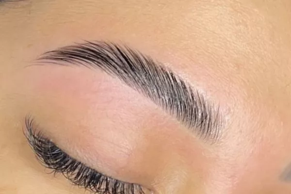 Browlift