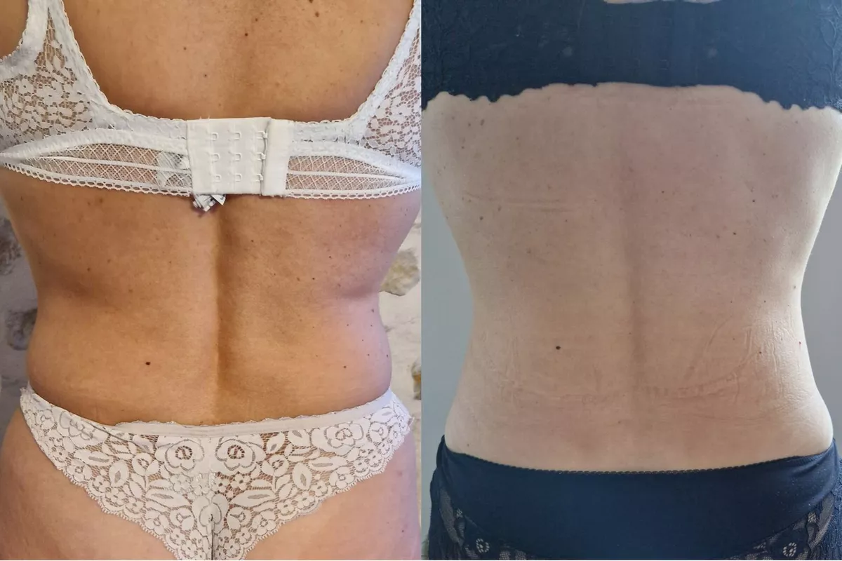 Enveloppement Minceur /zones ciblées