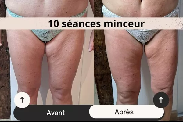 Cure minceur personnalisé