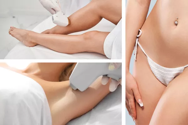Épilation Laser - Demi jambes + Maillot intégral + Aisselles + SIF offert