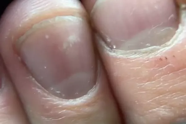 Menicure