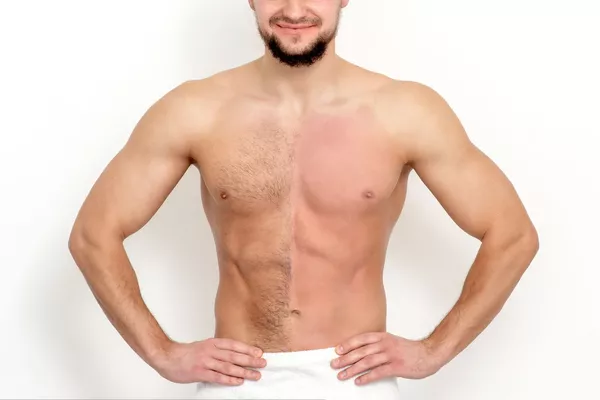 Torse Cire Epiloderm