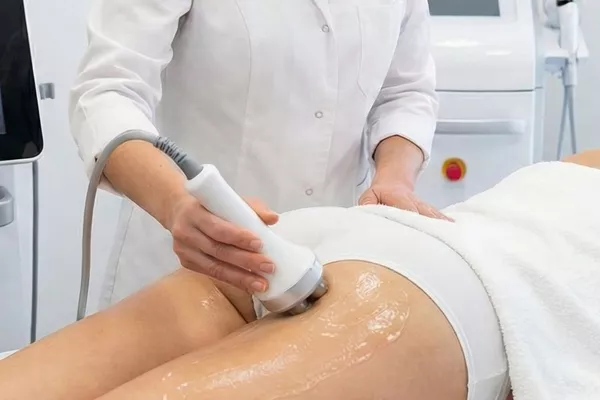 Radiofréquence fesses