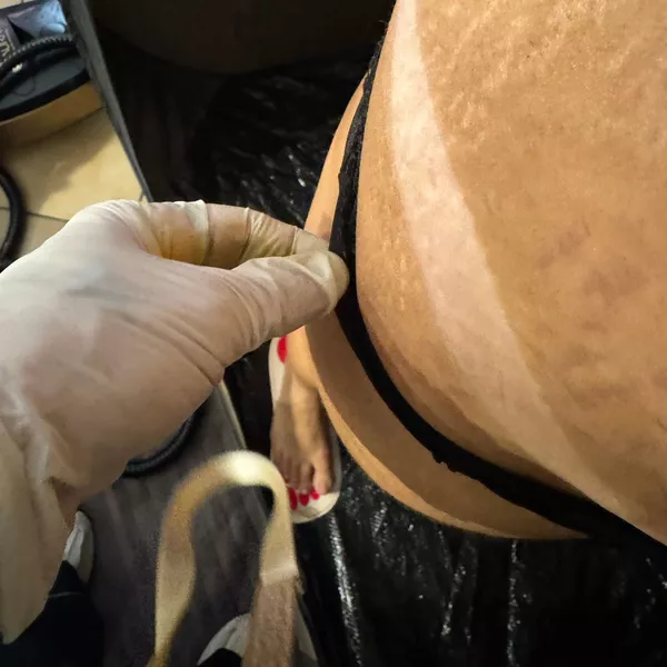 Spray tan bronzage