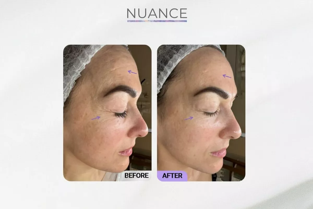 Soin Nuance de Christina Cosmeceuticals® - Peaux Matures