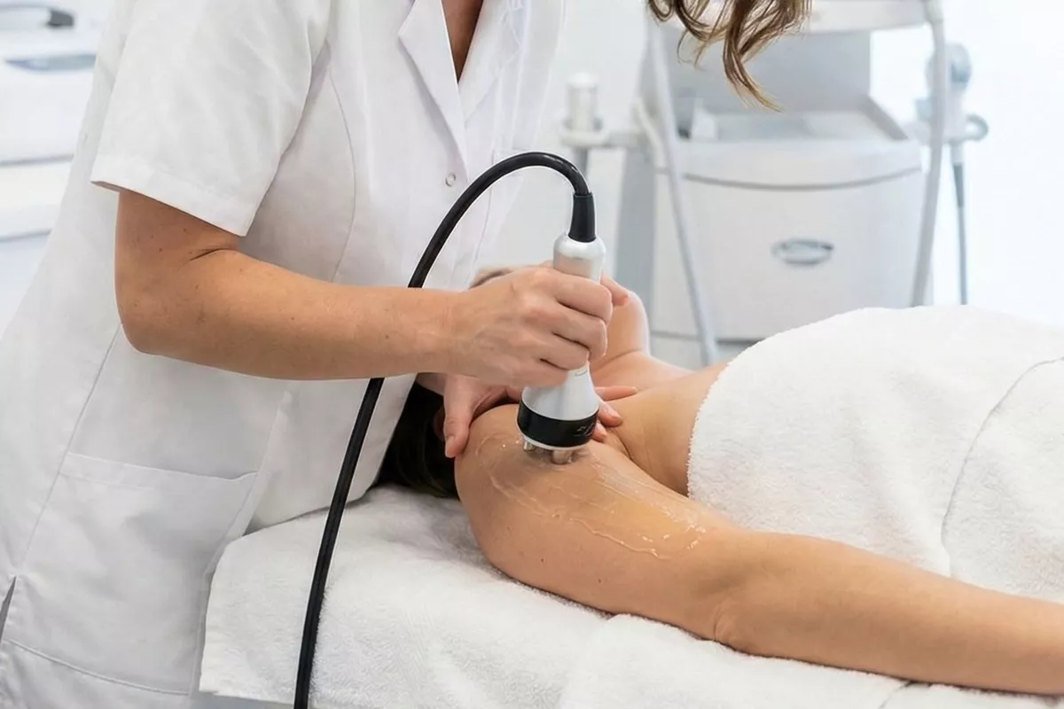 Radiofréquence bras