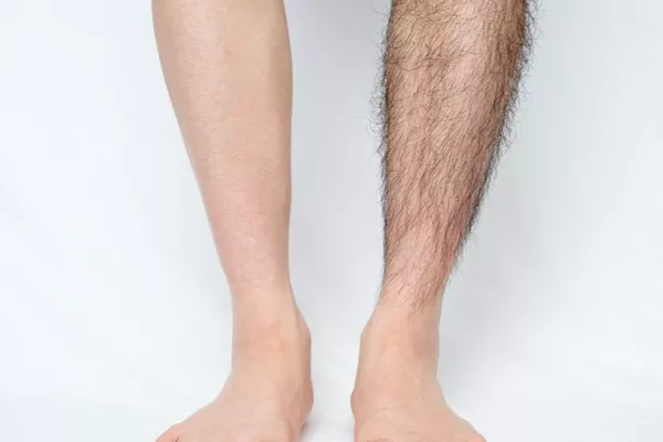 Jambes complètes Cire Epiloderm