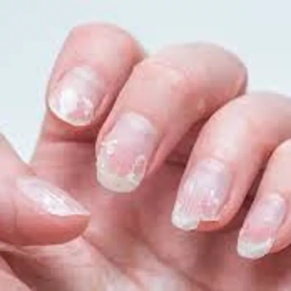 Ongles mous : causes, solutions et conseils d'une prothésiste ongulaire