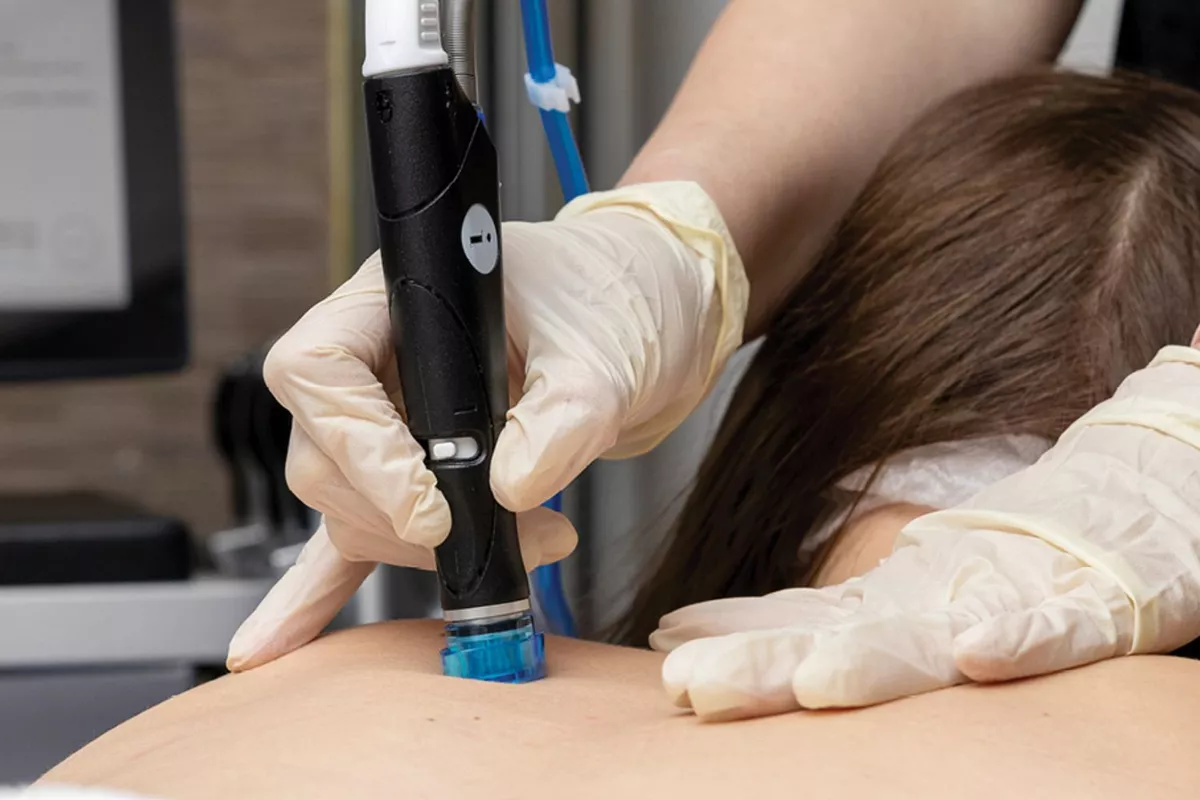 Hydrafacial Dos – Soin anti-boutons