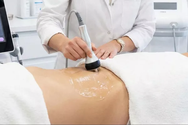 Radiofréquence abdomen