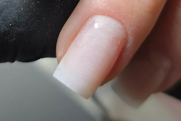 Réparation ongle