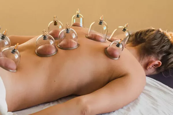 Cupping Hijama Corps entier