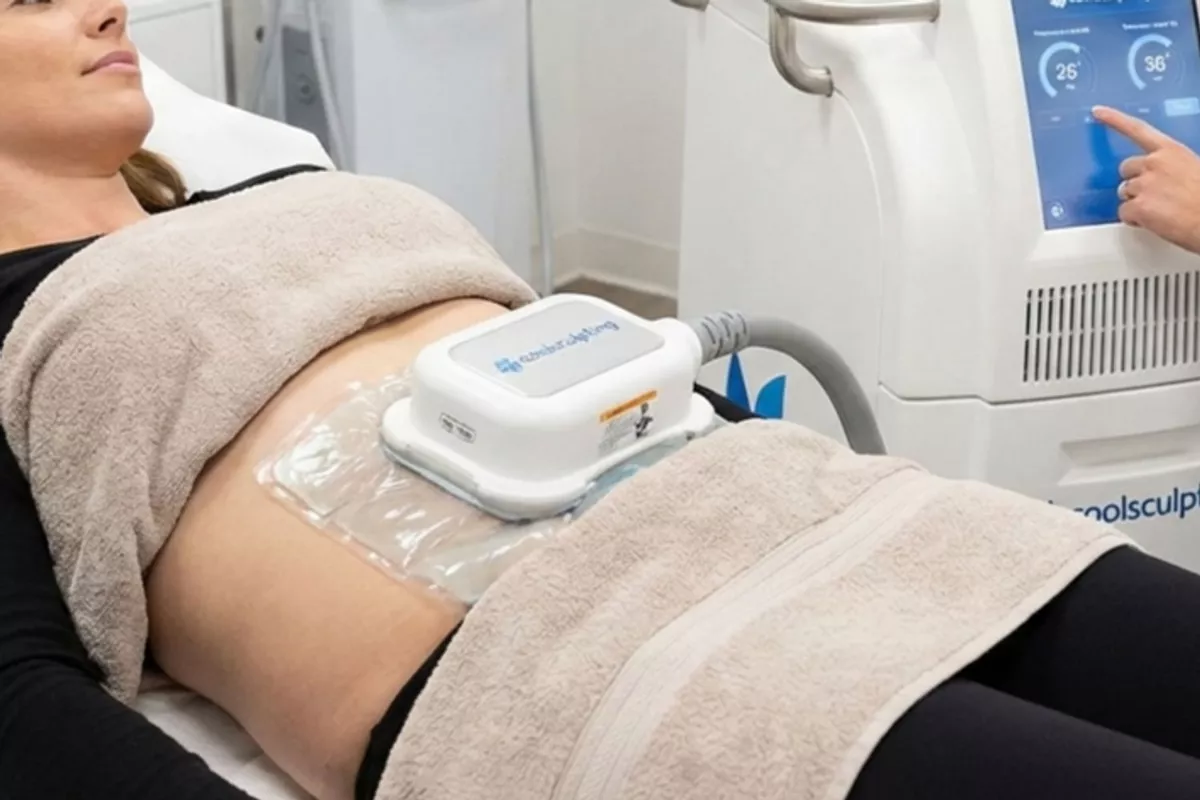 Séance de cryolipolyse – 2 zones traitées