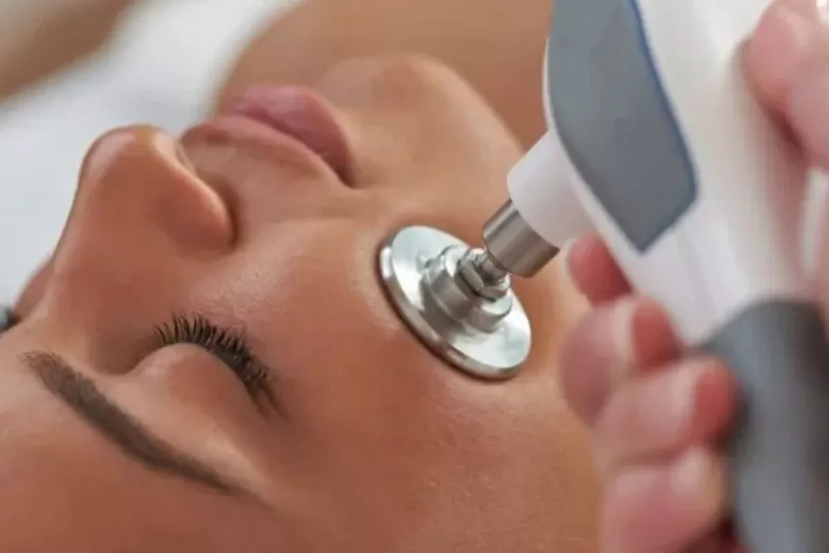 Microdermabrasion Bois-Guillaume