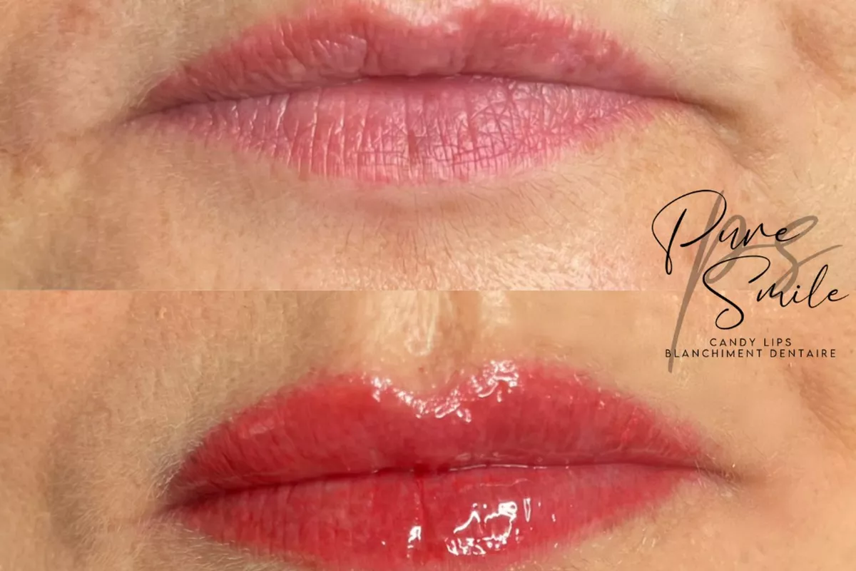 Maquillage Permanent des Lèvres ( Candy Lips )