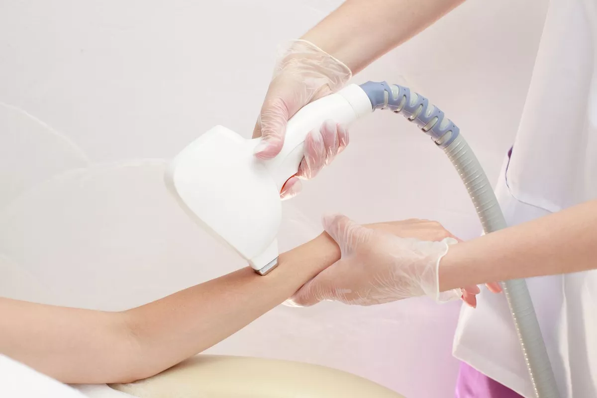 Épilation définitive corps au laser diode – Bras entiers