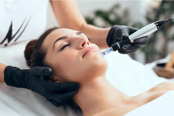 Needling Cure 4 seances