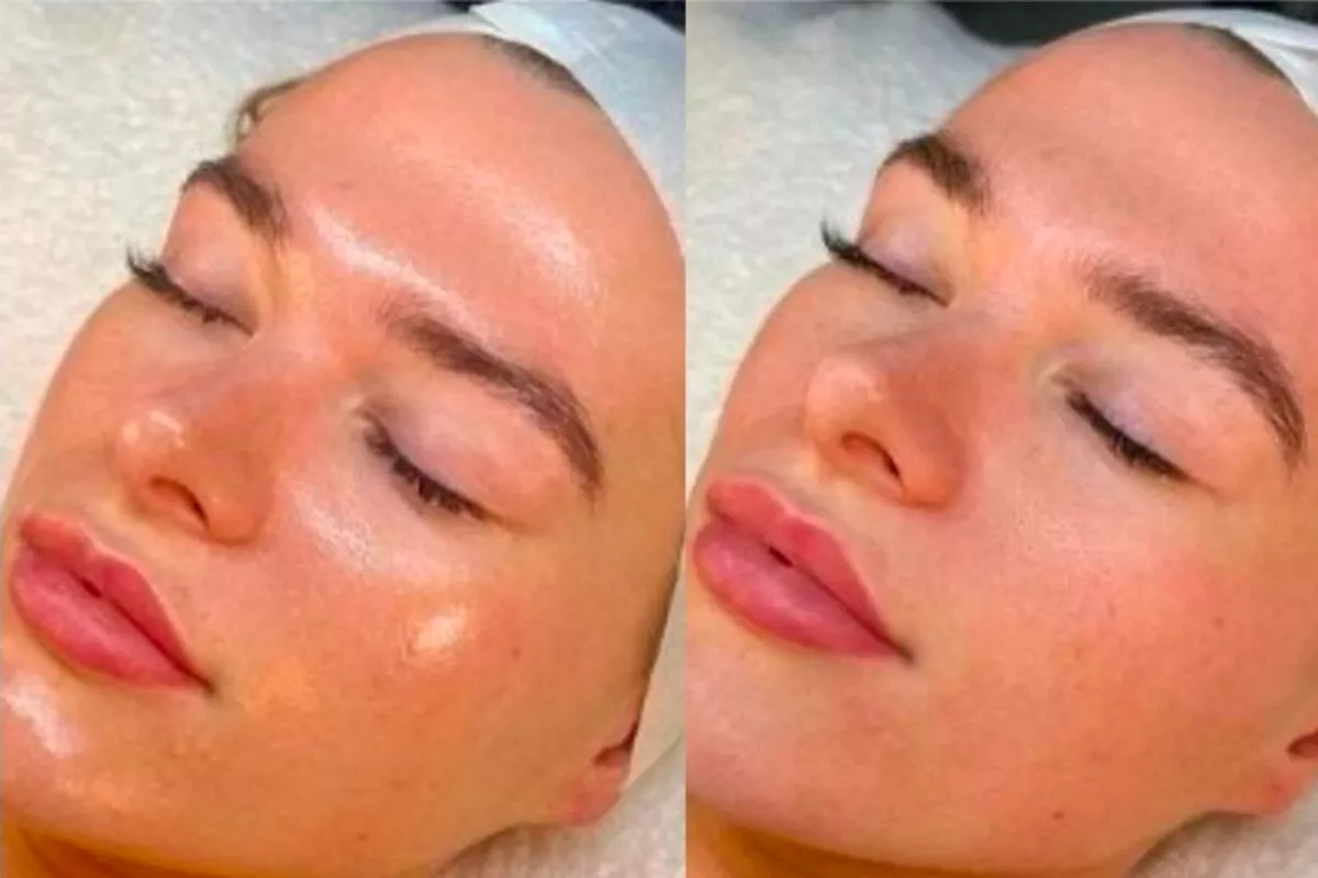 Formation Esthétique Bois-Guillaume