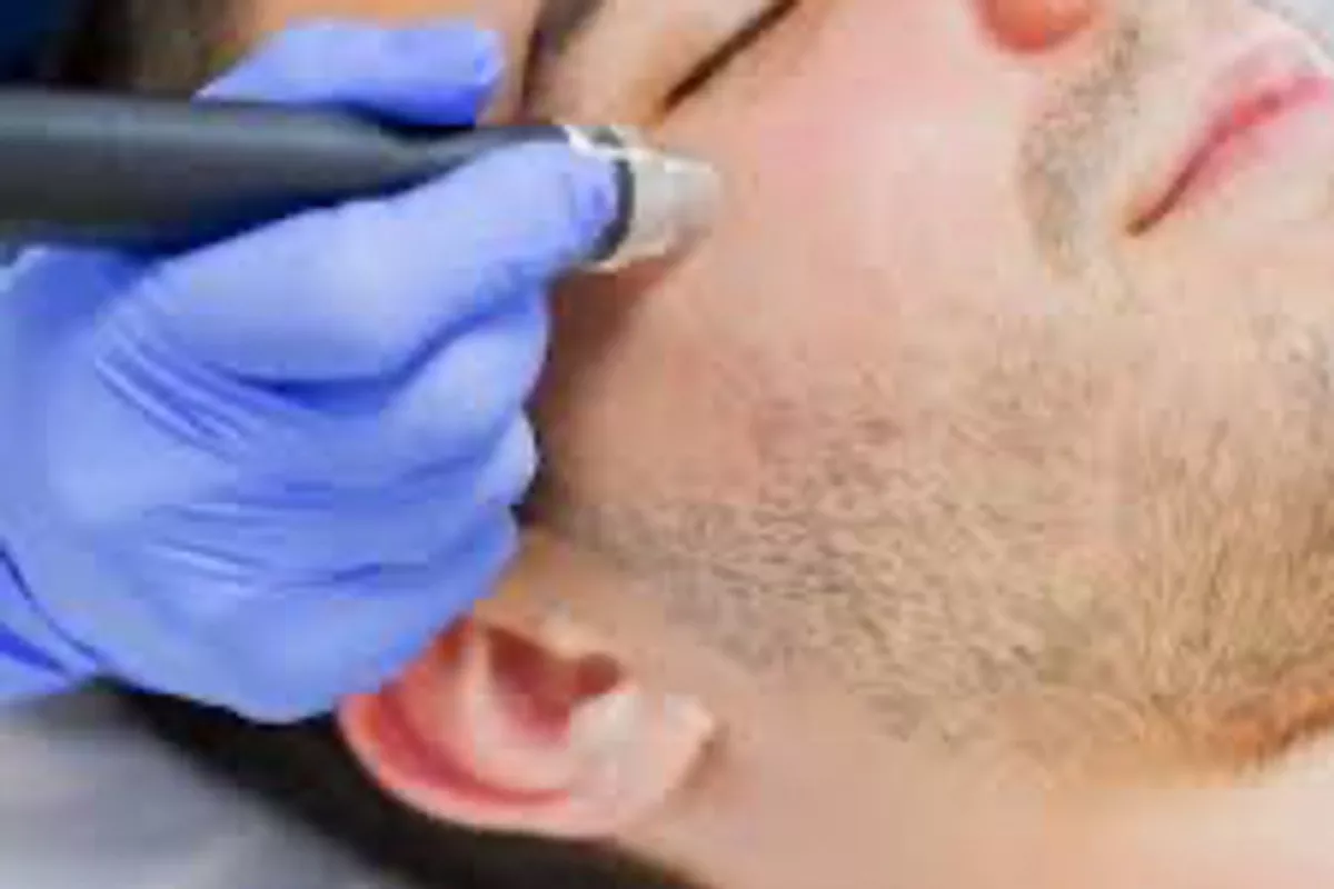 NETTOYAGE PROFOND DU VISAGE – SPÉCIAL HOMMES