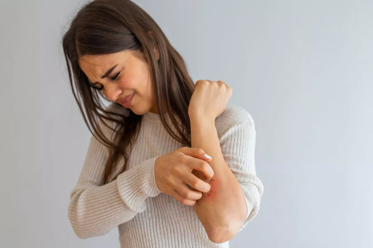 Magnétisme : consultation eczéma adulte