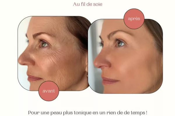 Soin anti-âge en profondeur