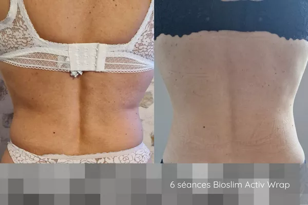 Forfait 6 séances Bioslim Activ Wrap/zones : ventre + poignées d'amours ou cuisses + fesses