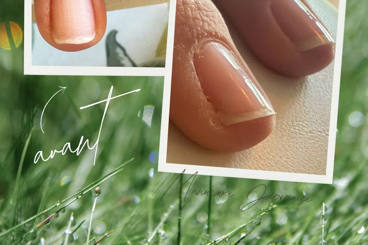 Sophrologue Moulins-Engilbert