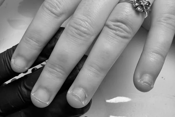 Extension au Gel pour Ongles Rongés