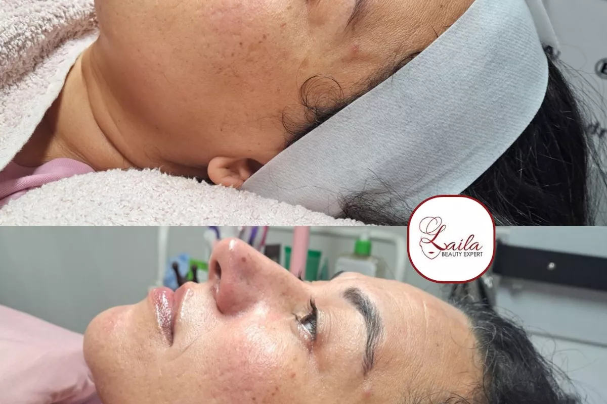 Formation professionnelle Hydrafacial Bois-Guillaume