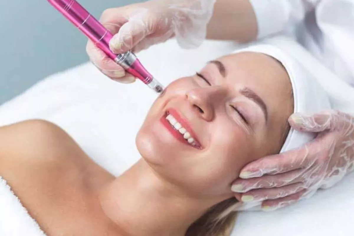 MICRONEEDLING & NANONEEDLING
