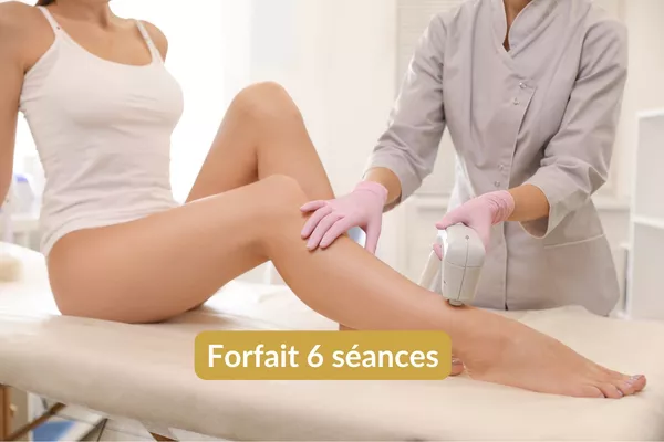 Épilation lumière pulsée Jambes entières - Forfait 6 séances
