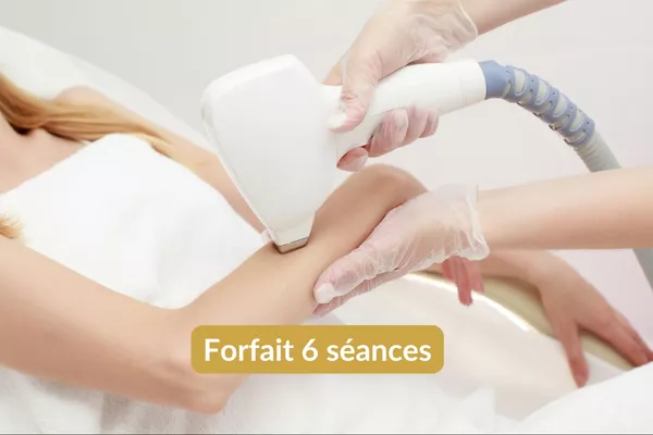 Épilation lumière pulsée Avant-bras - Forfait 6 séances
