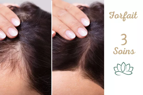 Forfait 3 soins capillaires du Dr CYJ Hair Fille