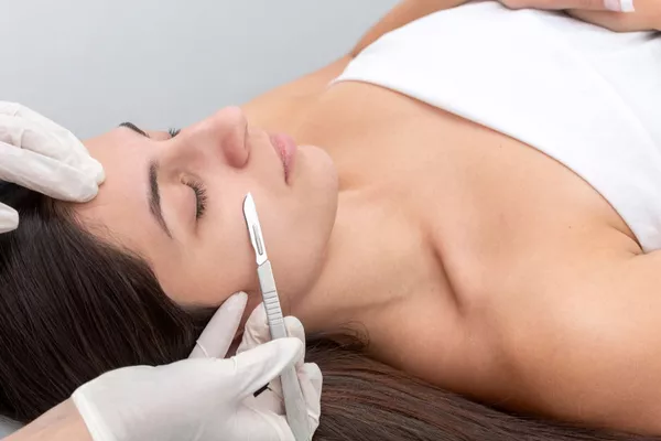Dermaplannig