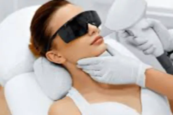 Laser visage complet