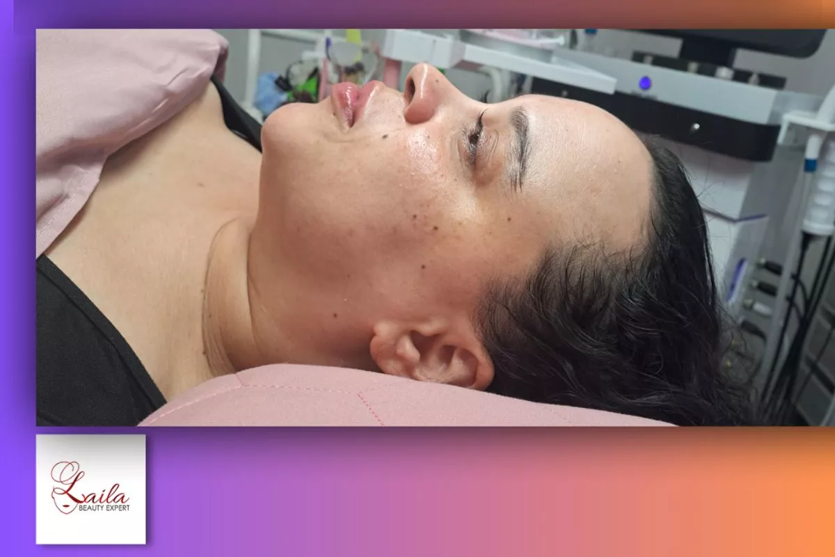 Soins anti taches sombres Bois-Guillaume