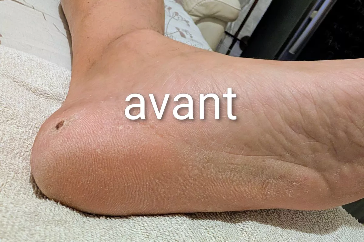 Vente de produits de bien-être La Seyne-sur-Mer