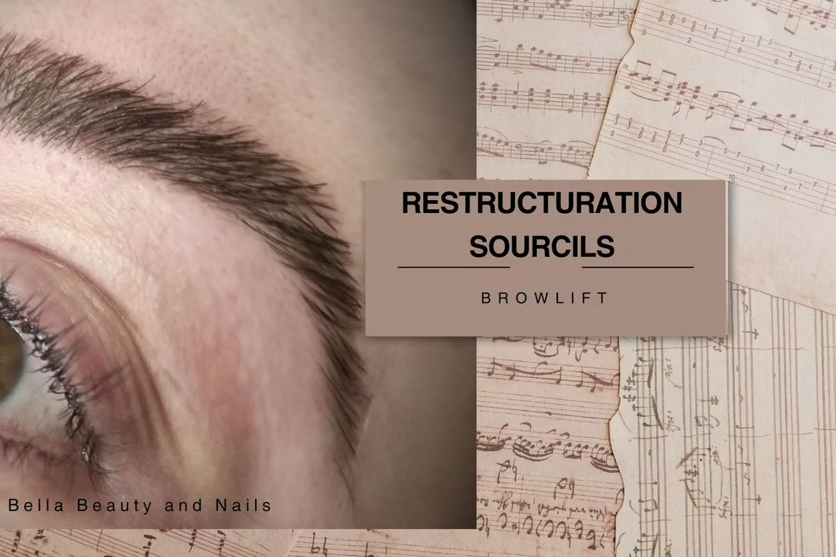 Forfait restructuration des sourcils (Browlift)