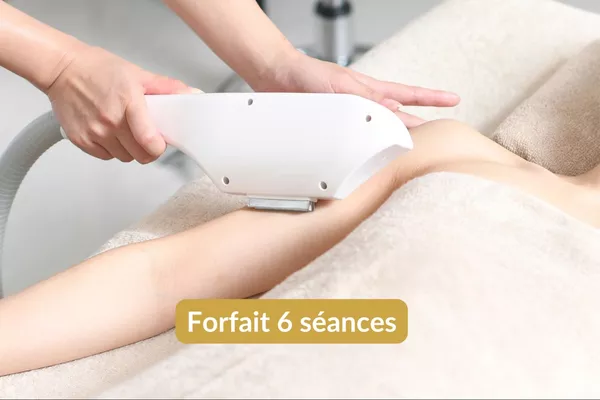 Épilation lumière pulsée Bras - Forfait 6 séances