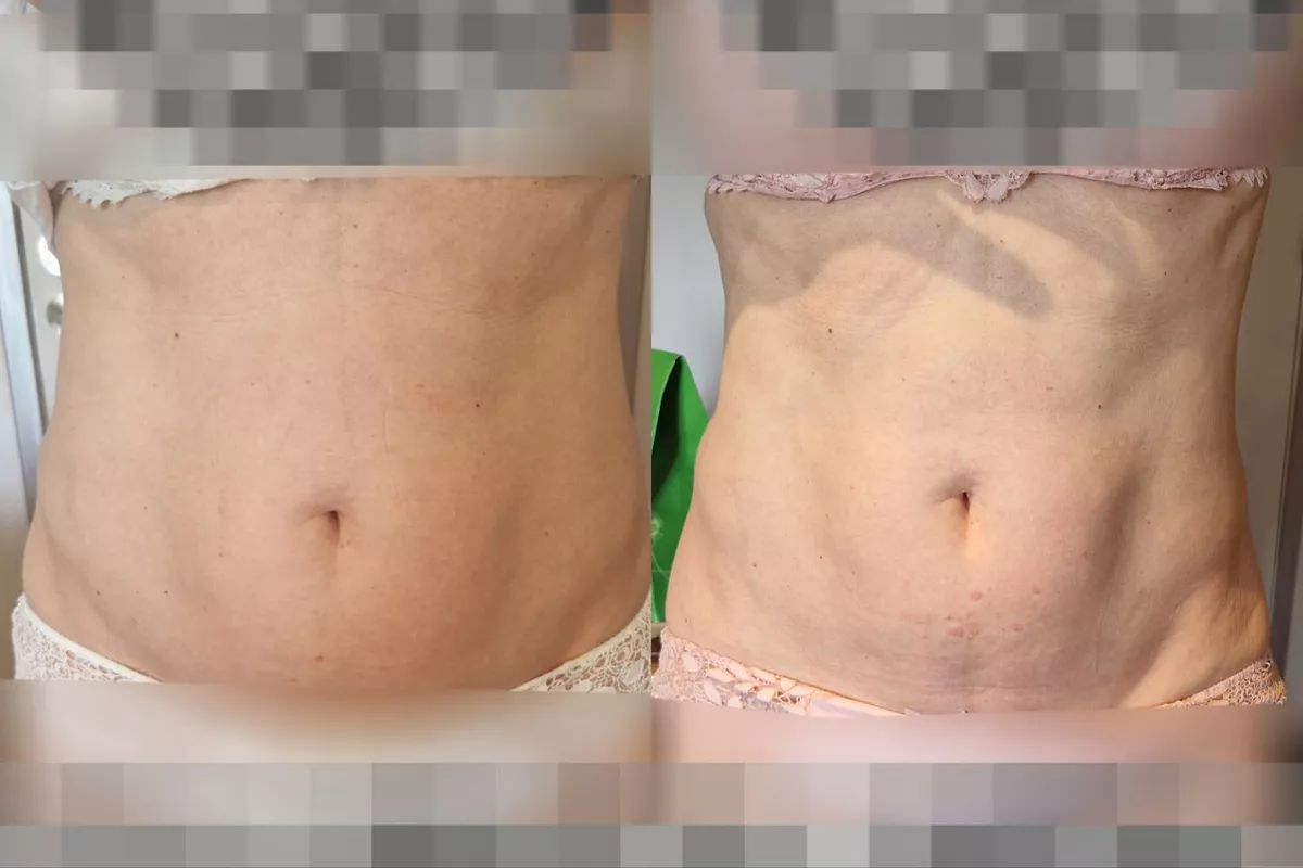 Body Sculpt Ventre Signature