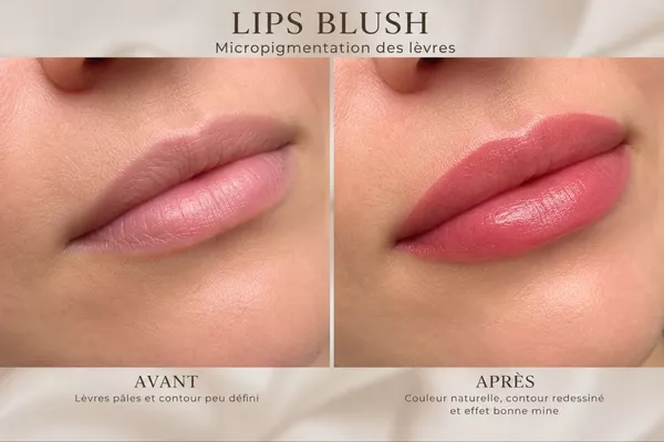 MICROPIGMENTATION DES LÈVRES