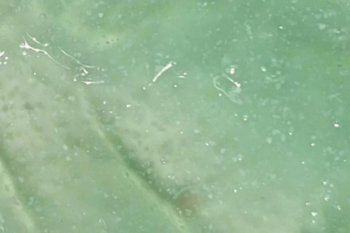 Soin Minceur Anti-cellulite