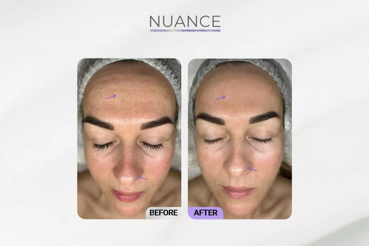Soin Nuance de Christina Cosmeceuticals® - Peaux Matures
